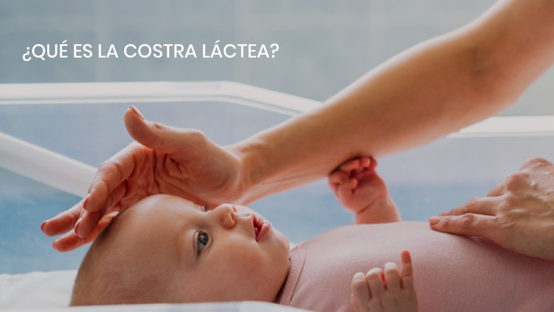 ¿Qué es la costra láctea?