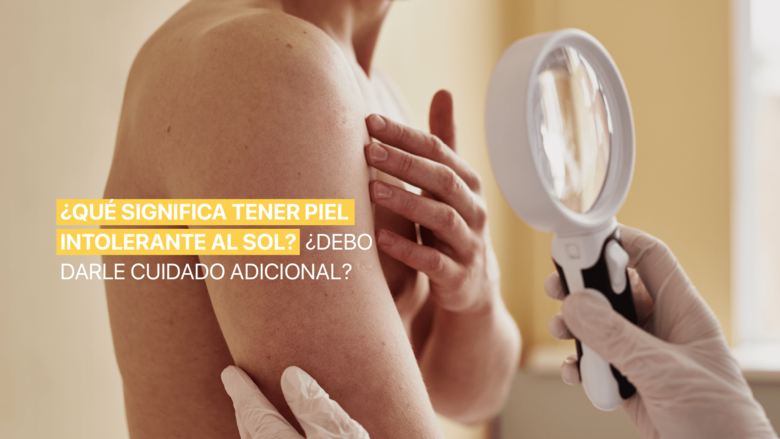 ¿Qué significa tener piel intolerante al sol? ¿Debo darle cuidado adicional?