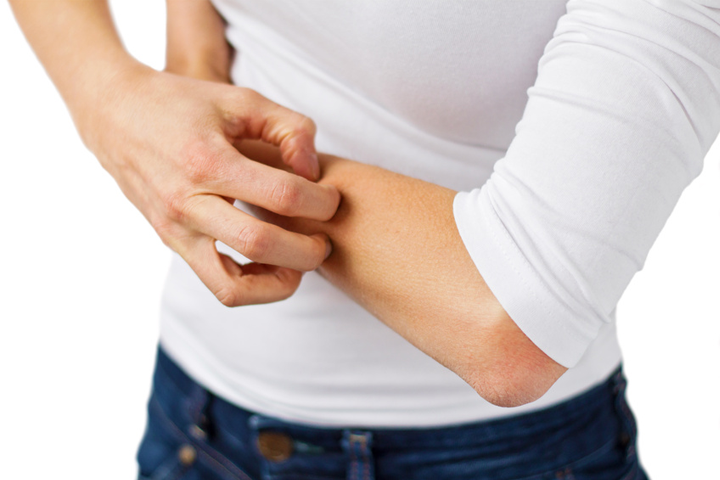 ¿Qué es un eczema?